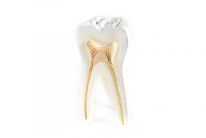 Root Canal Treatment